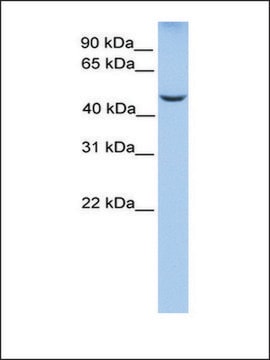 Anti-PHF17 (AB2) antibody produced in rabbit affinity isolated antibody