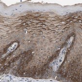 Anti-ADGRL3 antibody produced in rabbit Prestige Antibodies&#174; Powered by Atlas Antibodies, affinity isolated antibody, buffered aqueous glycerol solution