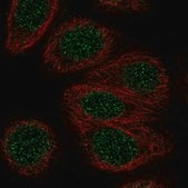 Anti-ZNF653 antibody produced in rabbit Prestige Antibodies&#174; Powered by Atlas Antibodies, affinity isolated antibody, buffered aqueous glycerol solution