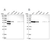 Anti-ERO1A antibody produced in rabbit Prestige Antibodies&#174; Powered by Atlas Antibodies, affinity isolated antibody, buffered aqueous glycerol solution
