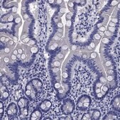 Anti-TFR2 antibody produced in rabbit Prestige Antibodies&#174; Powered by Atlas Antibodies, affinity isolated antibody, buffered aqueous glycerol solution