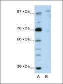 Anti-GLIS3 antibody produced in rabbit IgG fraction of antiserum