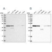 Anti-PPP1R8 antibody produced in rabbit Prestige Antibodies&#174; Powered by Atlas Antibodies, affinity isolated antibody, buffered aqueous glycerol solution, Ab1