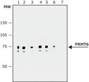 Anti-PRMT6 (SE-15) antibody produced in rabbit ~0.9 mg/mL, affinity isolated antibody, buffered aqueous solution