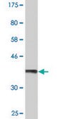 Monoclonal Anti-ANXA2 antibody produced in mouse clone 4G8, purified immunoglobulin, buffered aqueous solution