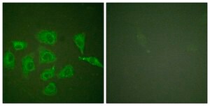 Anti-TRK A antibody produced in rabbit affinity isolated antibody