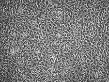 YUMMER1G.1F Mouse Cell Line