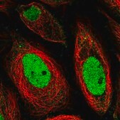 Anti-LRRC61 antibody produced in rabbit Prestige Antibodies&#174; Powered by Atlas Antibodies, affinity isolated antibody, buffered aqueous glycerol solution