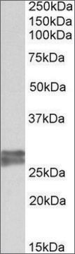 Anti-TNNI3 antibody produced in goat affinity isolated antibody, buffered aqueous solution