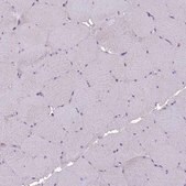 Anti-NLRP11 antibody produced in rabbit Prestige Antibodies&#174; Powered by Atlas Antibodies, affinity isolated antibody, buffered aqueous glycerol solution