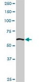 Anti-ELAC2 antibody produced in rabbit purified immunoglobulin, buffered aqueous solution