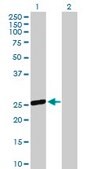Anti-OSTF1 antibody produced in mouse purified immunoglobulin, buffered aqueous solution