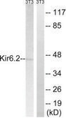 Anti-KIR6.2 antibody produced in rabbit affinity isolated antibody