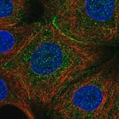 Anti-C11orf52 antibody produced in rabbit Prestige Antibodies&#174; Powered by Atlas Antibodies, affinity isolated antibody, buffered aqueous glycerol solution