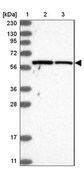 Anti-SAMD3 antibody produced in rabbit Prestige Antibodies&#174; Powered by Atlas Antibodies, affinity isolated antibody, buffered aqueous glycerol solution, ab1