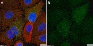 Anti-GCLC Antibody, clone 2H13 ZooMAb&#174; Rabbit Monoclonal recombinant, expressed in HEK 293 cells