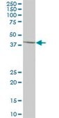Anti-SCCPDH antibody produced in mouse purified immunoglobulin, buffered aqueous solution