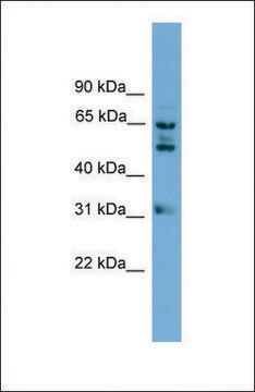 Anti-WDR16 antibody produced in rabbit affinity isolated antibody