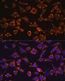 Anti-IL18 antibody produced in rabbit