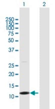 Anti-TCL1B antibody produced in rabbit purified immunoglobulin, buffered aqueous solution