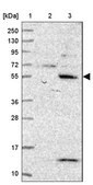 Anti-KBTBD11 antibody produced in rabbit Prestige Antibodies&#174; Powered by Atlas Antibodies, affinity isolated antibody, buffered aqueous glycerol solution