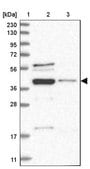 Anti-RBMX2 antibody produced in rabbit Prestige Antibodies&#174; Powered by Atlas Antibodies, affinity isolated antibody, buffered aqueous glycerol solution