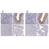 Anti-ADGRG2 antibody produced in rabbit Prestige Antibodies® Powered by Atlas Antibodies, affinity isolated antibody, buffered aqueous glycerol solution