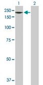 Anti-MAGEE1 antibody produced in mouse purified immunoglobulin, buffered aqueous solution