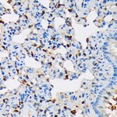 Anti-RPB3/POLR2C Antibody, clone 3T8K8, Rabbit Monoclonal