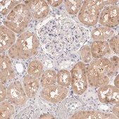 Anti-FABP1 antibody produced in rabbit Prestige Antibodies&#174; Powered by Atlas Antibodies, affinity isolated antibody, buffered aqueous glycerol solution