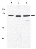 Anti-TIRP Antibody from rabbit, purified by affinity chromatography