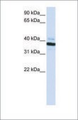 Anti-OAS1 antibody produced in rabbit affinity isolated antibody