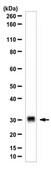 Anti-ANT2 Antibody from rabbit, purified by affinity chromatography
