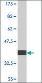 Monoclonal Anti-UBE4B, (C-terminal) antibody produced in mouse clone 1D5, purified immunoglobulin, buffered aqueous solution