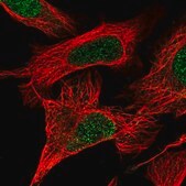 Anti-DOCK1 antibody produced in rabbit Prestige Antibodies&#174; Powered by Atlas Antibodies, affinity isolated antibody, buffered aqueous glycerol solution