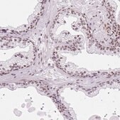 Anti-LUC7L2 antibody produced in rabbit Prestige Antibodies&#174; Powered by Atlas Antibodies, affinity isolated antibody, buffered aqueous glycerol solution