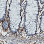 Monoclonal Anti-FBN1 antibody produced in mouse Prestige Antibodies&#174; Powered by Atlas Antibodies, clone CL0226, purified immunoglobulin, buffered aqueous glycerol solution