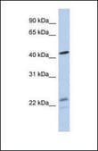 Anti-BCKDHA, (N-terminal) antibody produced in rabbit affinity isolated antibody