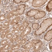 Anti-TRIM11 antibody produced in rabbit Prestige Antibodies&#174; Powered by Atlas Antibodies, affinity isolated antibody, buffered aqueous glycerol solution