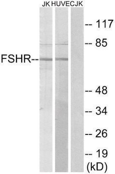 抗 FSHR 兔抗 affinity isolated antibody