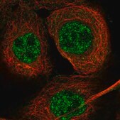 Anti-EXO5 antibody produced in rabbit Prestige Antibodies® Powered by Atlas Antibodies, affinity isolated antibody, buffered aqueous glycerol solution