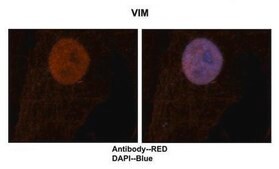 Anti-VIM affinity isolated antibody