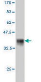Monoclonal Anti-FZD5 antibody produced in mouse clone 6A3, purified immunoglobulin, buffered aqueous solution