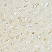 Anti-BCL2 antibody produced in rabbit