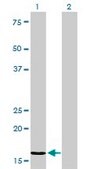 Monoclonal Anti-NME2 antibody produced in mouse clone 4B7-3F12, purified immunoglobulin, buffered aqueous solution