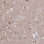 Anti-PRR5 antibody produced in rabbit Prestige Antibodies® Powered by Atlas Antibodies, affinity isolated antibody, buffered aqueous glycerol solution