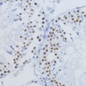 Anti-DiMethyl-Histone H3-K36 antibody produced in rabbit