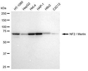KD-Validated Anti NF2 / Merlin Antibody, clone 23GB2620, Rabbit Monoclonal clone 23GB2620, recombinant rabbit monoclonal, expressed in HEK293 cells