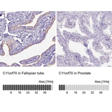 Anti-C11orf70 antibody produced in rabbit Prestige Antibodies&#174; Powered by Atlas Antibodies, affinity isolated antibody, buffered aqueous glycerol solution