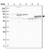 Anti-ABLIM2 antibody produced in rabbit Prestige Antibodies&#174; Powered by Atlas Antibodies, affinity isolated antibody, buffered aqueous glycerol solution